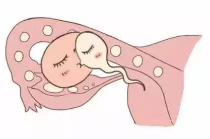 代怀选性别包生男孩代生医院